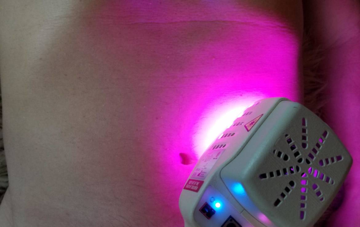 FireFly Light Therapy